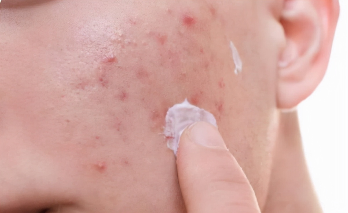 面部皮膚油膩？學(xué)會(huì)這3個(gè)洗臉小技巧，讓你遠(yuǎn)離“毛孔粗大”煩惱