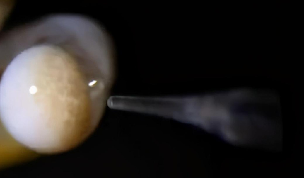 產(chǎn)雄蜂的王如何人工授精（蜂王人工授精技術(shù)視頻）